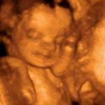 Седьмой месяц беременности, развитие плода и ощущения матери